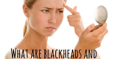 Easy method to remove blackheads!