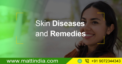 Skin Diseases and Remedies
