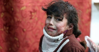 WILL YOU SUPPORT SYRIAN KIDS?